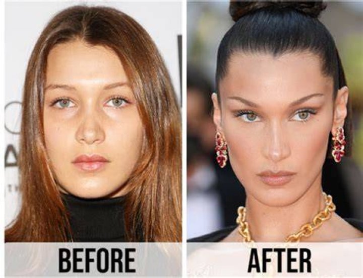 Bella Hadid Chirurgie, Bella Hadid Nose, Bella Hadid Makeup, Gigi Hadid
