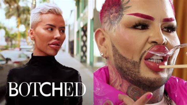 Botched Patient Can Literally Flip Her Butt Implants?Watch the Insane