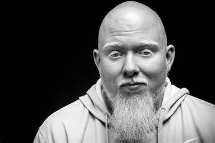 Brother Ali Alchetron, The Free Social Encyclopedia