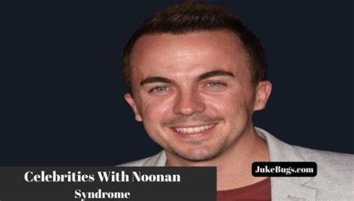 Celebrities With Noonan Syndrome Fact After Fact Mag