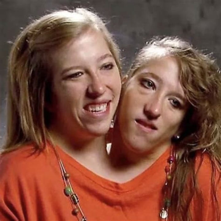 Conjoined Twin Sisters Abigail And Brittany Hensel Ha vrogue.co