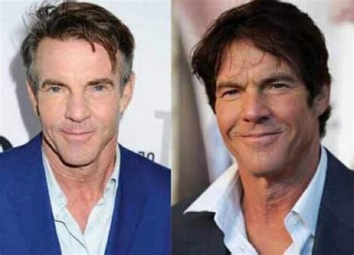Dennis Quaid's Plastic Surgery: Enhancing His Youthful Appearance