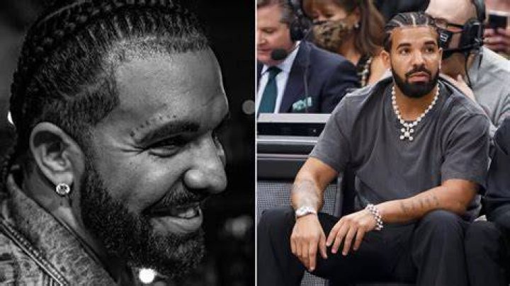 Drakes tatueringsmiss tatuerar "MISKEEN" i ansiktet Dopest