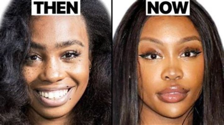 Fans Believe Sza Had Plastic Surgery, Reveal Photos Of Sza Before