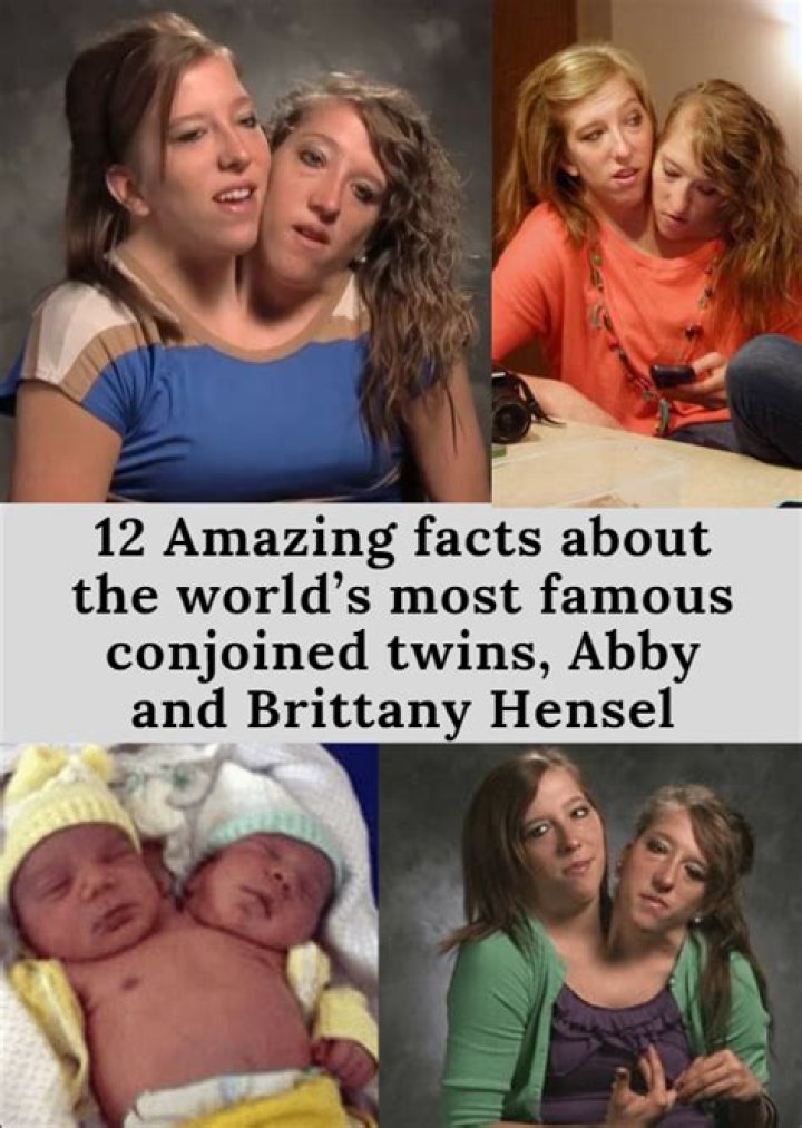 Fascinating Facts About Famous Conjoined Twins Abby And Brittany Hensel