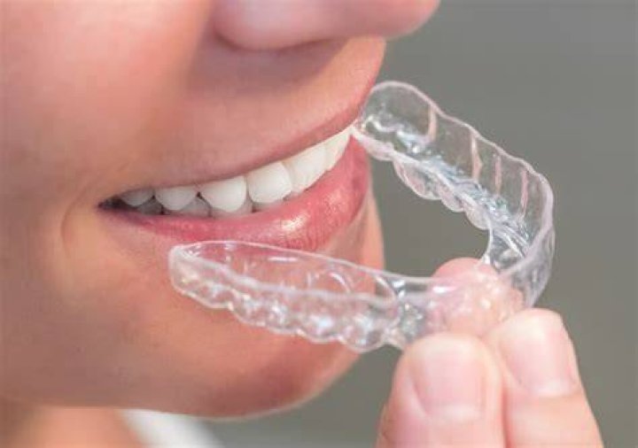 How much is a clear retainer?