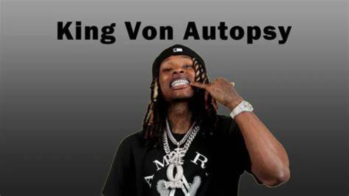 King Von Autopsy Report: The Shocking Details Revealed
