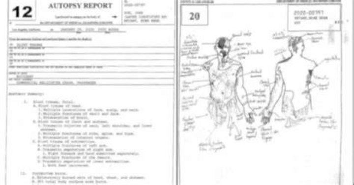 Kobe Bryants autopsy report r/TerrifyingAsFuck