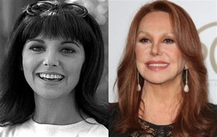 Marlo Thomas Plastic Surgery Nose Job Before and After Facelift, Botox