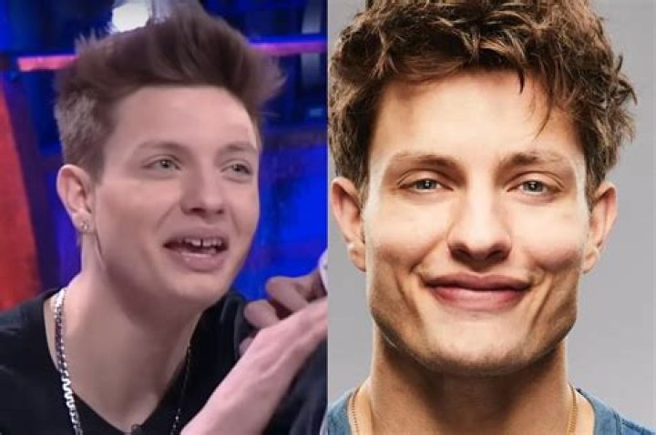 Matt Rife Before Fixing His Teeth The Wild &lsquo;n Out Star&rsquo;s Glow Up Examined!