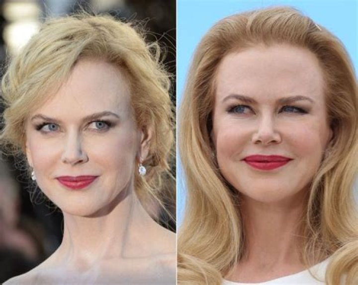 Nicole Kidman Before And After Telegraph