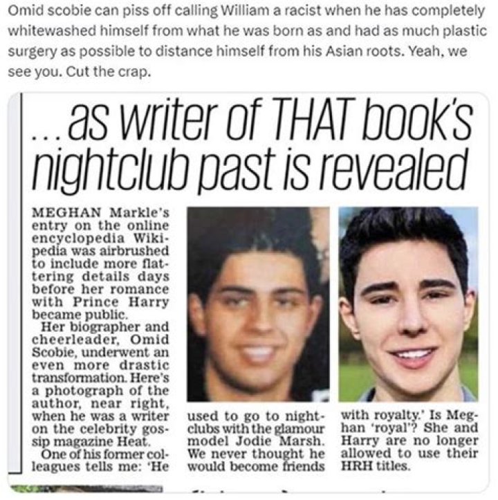 Omid Scobie Before And After Plastic Surgery Photos