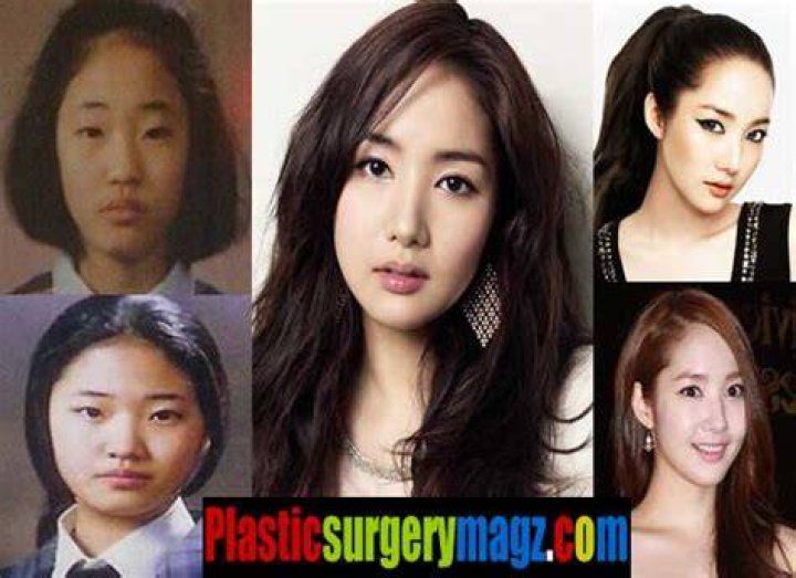 Park min young plastic surgery before and after pictures About Korean