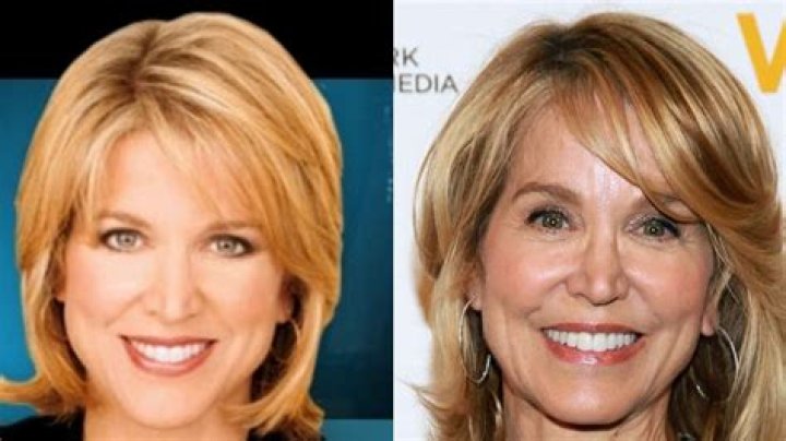 Paula Zahn with plastic surgery