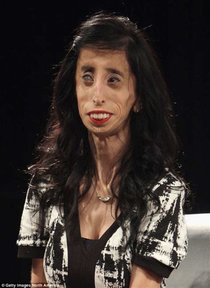 She Was Named World&rsquo;s Ugliest Dog, but &lsquo;She&rsquo;s Just Darling&rsquo; The New