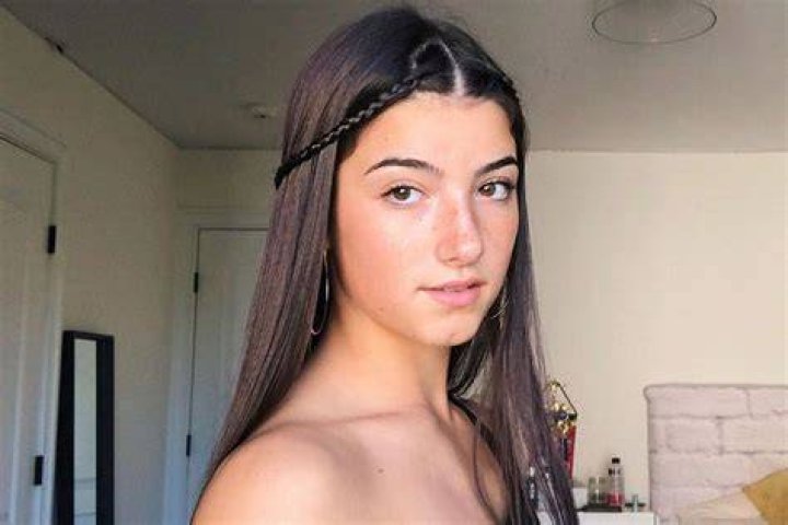 Tiktok Star Charli Damelio Reveals Struggle With Eating Disorders Hot