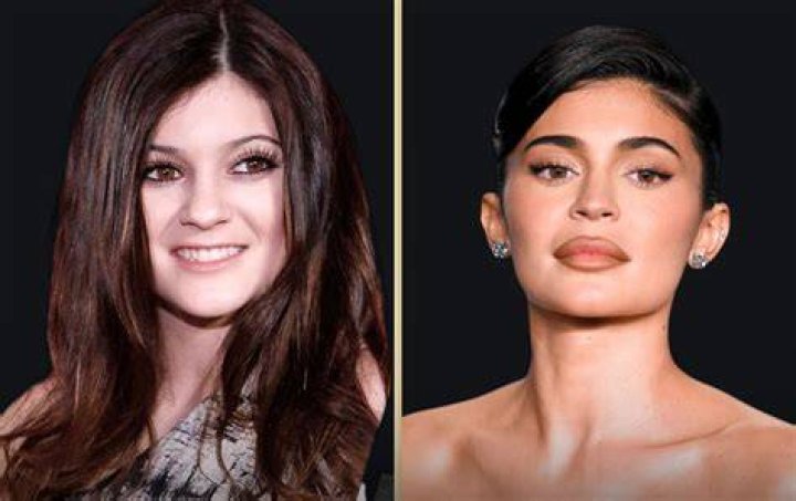 Unbelievable! How did Kylie Jenner get back in shape so quickly? View