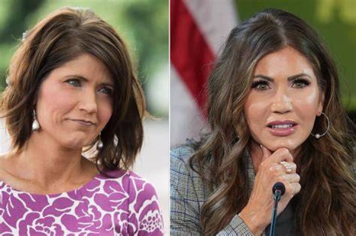 Unveiling The Journey: Kristi Noem's Alleged Plastic Surgery Transformation