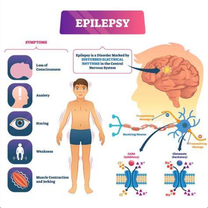What is a good job for someone with epilepsy?