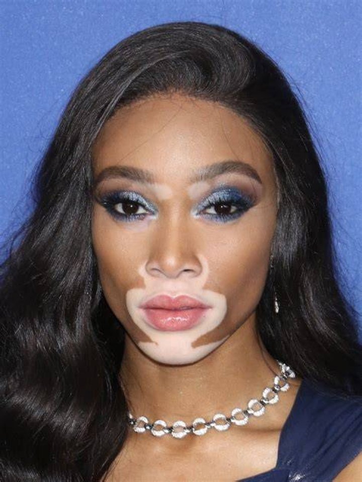 Winnie Harlow&rsquo;s Stank Attitude Almost Got Her Dragged at Party; Trey