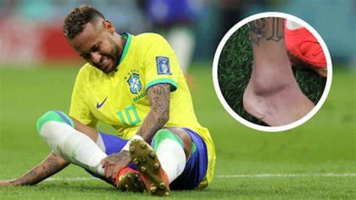 Worst Accidental Injuries In Youtube Videos Jojo Siwa Mrbeast My XXX
